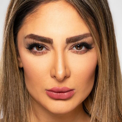 خرید لنز عسلی تیره Brown Tone3