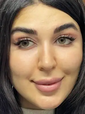 خرید لنز دهب نچرال هازل