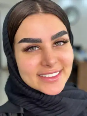 خرید لنز یونیک آلاماندا