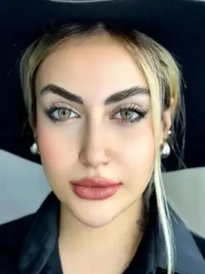 خرید لنز یونیک لیناریا