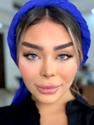 خرید لنز یونیک لوتوس