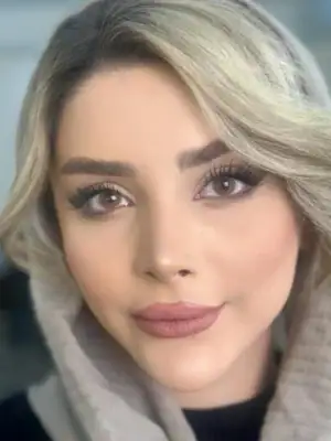 خرید لنز یونیک پارودیا