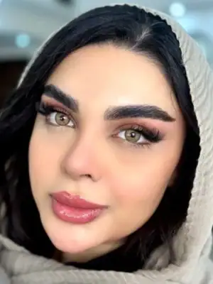 خرید لنز یونیک فلامینگو