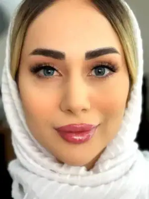 خرید لنز یونیک مگنولیا