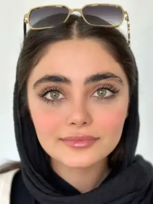 خرید لنز یونیک ویستریا