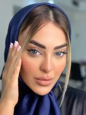خرید لنز یونیک اسکای فال