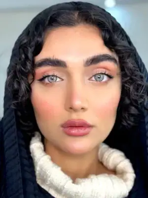 خرید لنز یونیک فلوریدا