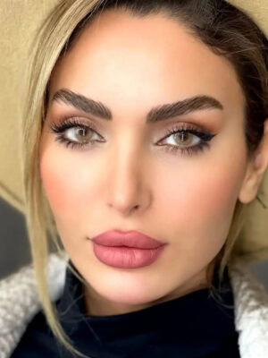 خرید لنز عسلی روشن Carolina