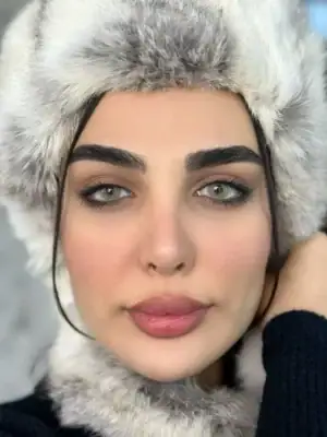 خرید لنز آیس کالر ونوس