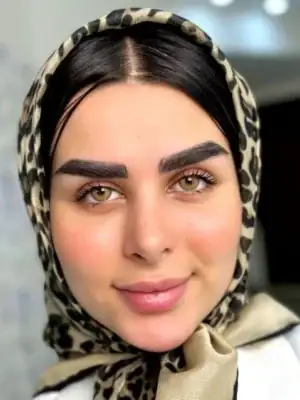 خرید لنز آیس کالر کارامل