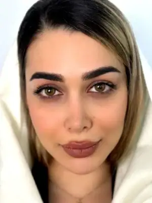 خرید لنز یونیک لاتینا
