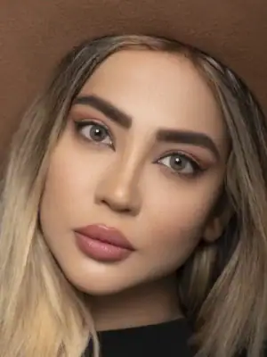 خرید لنز عسلی تیره Ruby Brown