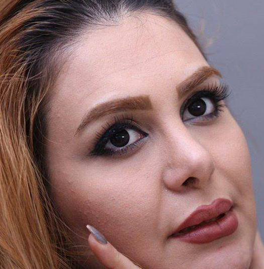 خرید لنز فستیوال مورنینگ بلک