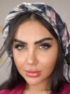 خرید لنز ترسا نوادا