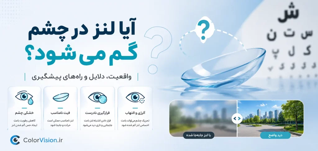 آیا لنز در چشم گم می شود؟