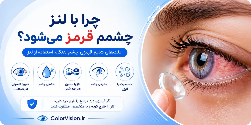 چرا با لنز چشمم قرمز می شود؟