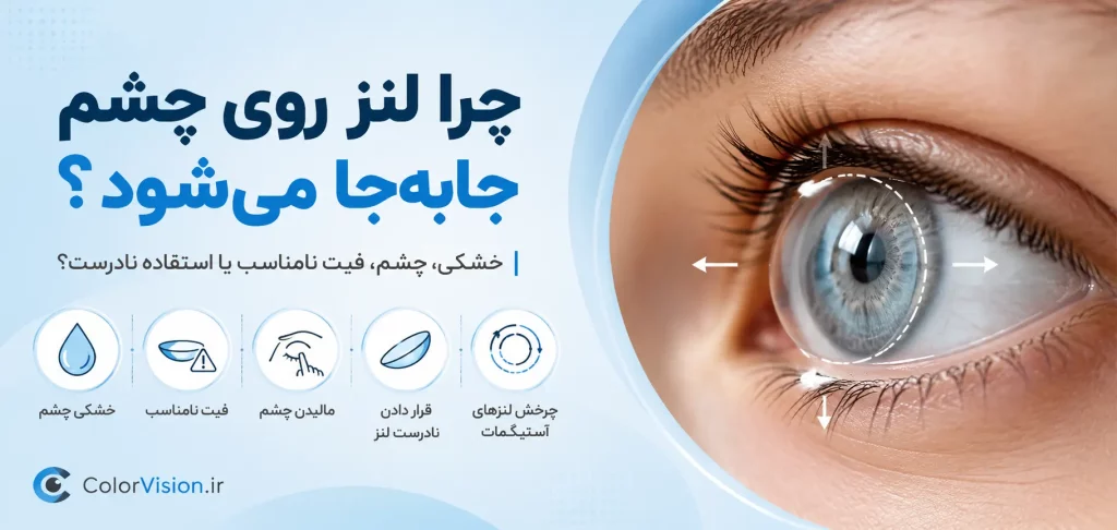 چرا لنز روی چشم جابه جا می شود؟